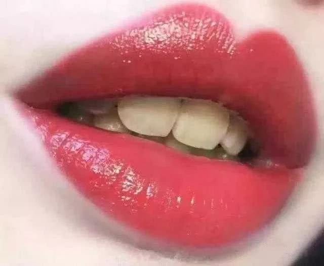 明星怎么美白牙齿 当红女星用偏方美白牙齿，不仅没变白牙齿还被