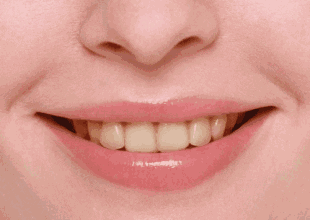 明星美白牙齿对比照片_明星怎么美白牙齿_牙齿美白明星有哪些